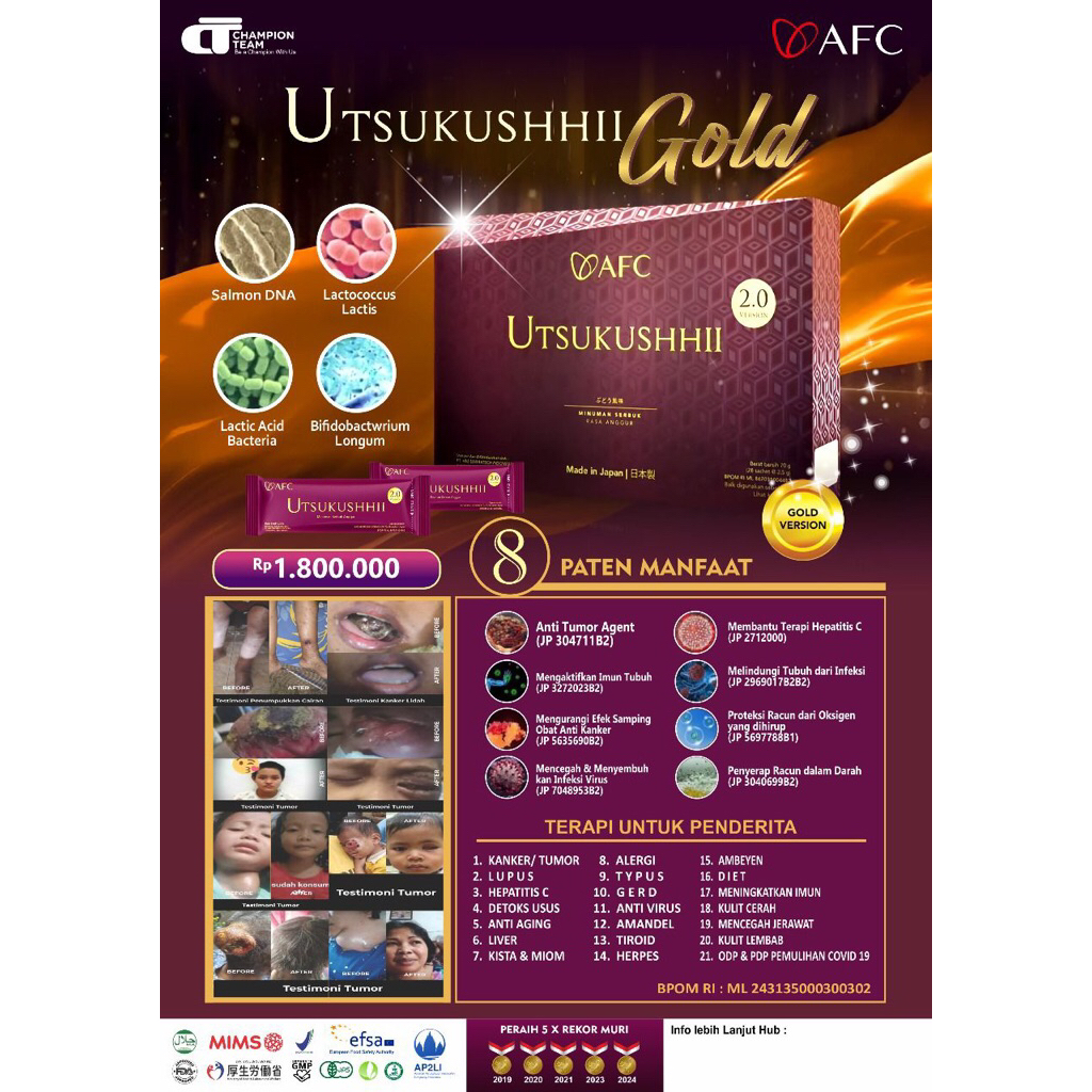 Utsukushhii Gold Sop Subarashi Hikari Afc Original