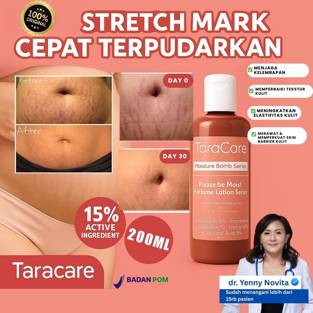 Lotion Bumil Aman Bpom– Taracare Moisture Bomb Untuk Kulit Kering,Mencegah Stretch Marks Cocok Untuk Ibu  Hamil