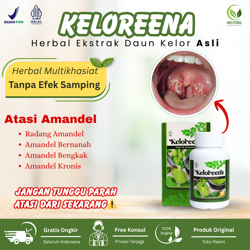 Obat Pengempis Amandel, Radang Amandel, Amandel Bernanah,Amandel Kronis, Amandel Bengkak - Keloreena