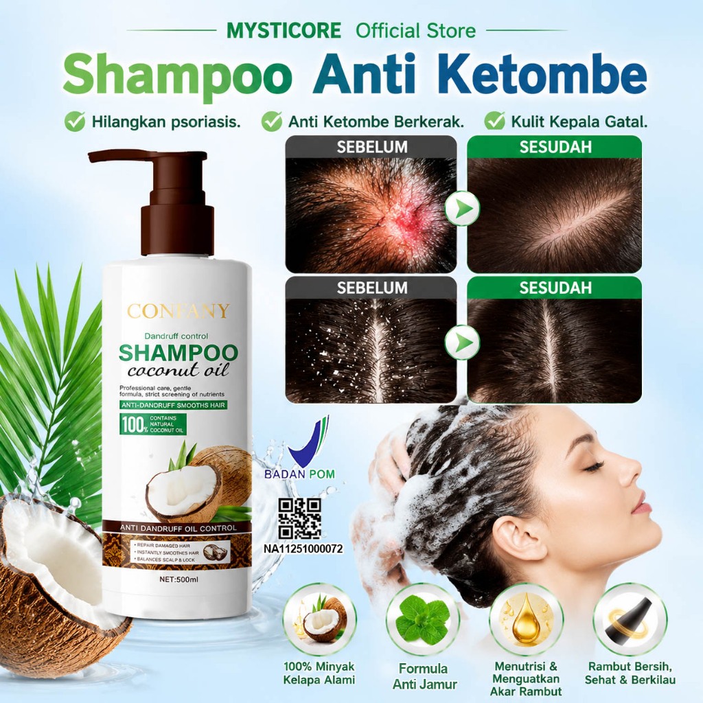 Shampoo anti dandruff Shampoo psoriasis kulit kepala Shampoo Anti Ketombe dan rontok Shampo Menghila