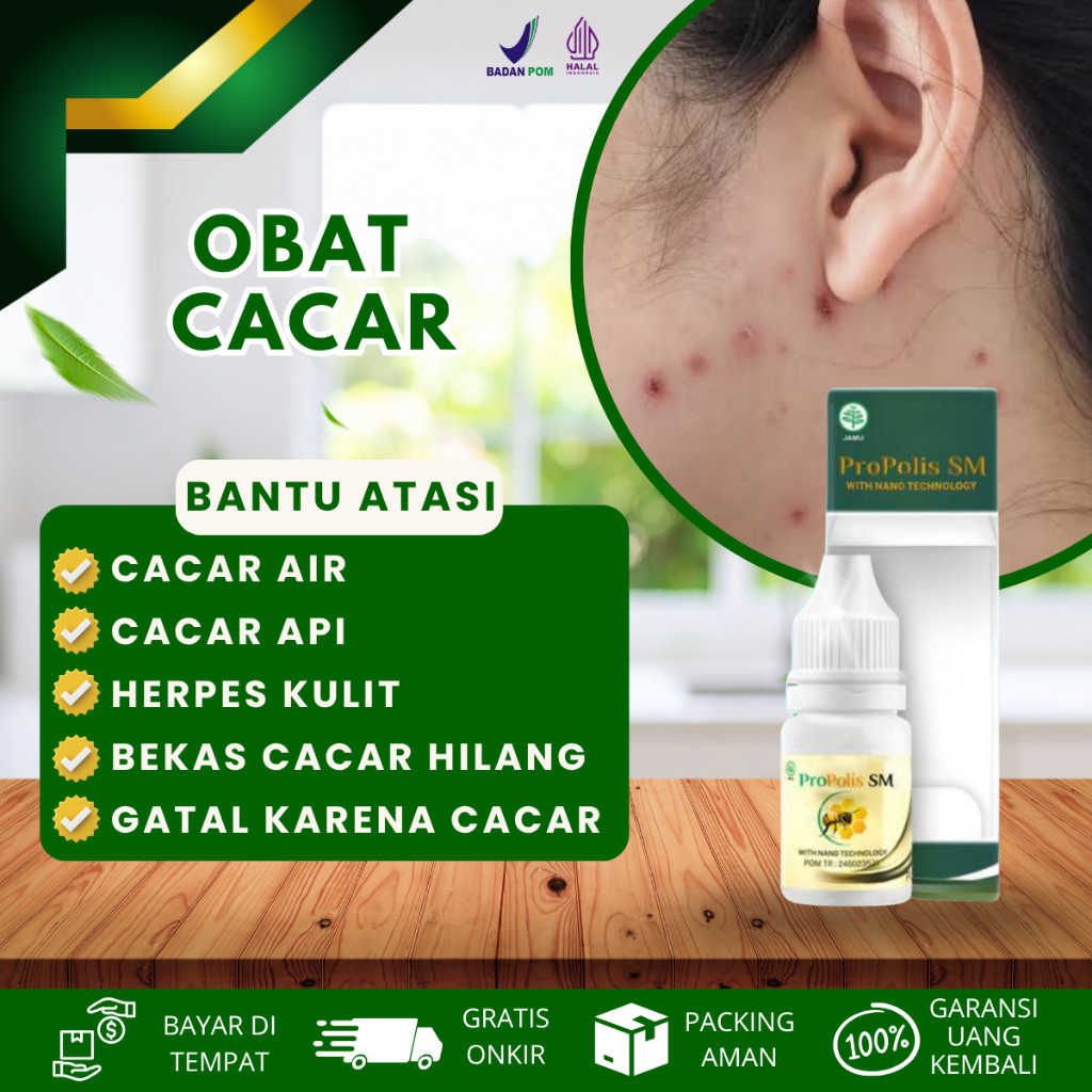 Obat Cacar Air, Obat Penghilang Bekas Cacar, Obat Bekas Cacar, Penghilang Bekas Cacar Air, Bekas Cac
