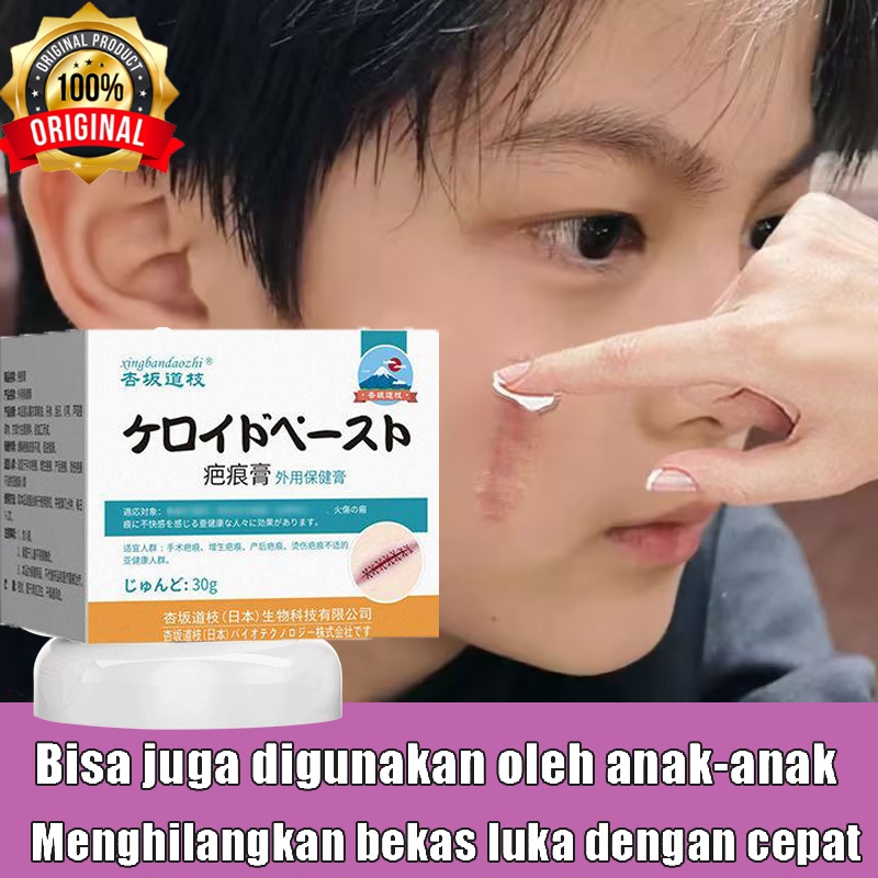 Penghilang bekas luka 30g Penghilang luka koreng bekas gatal gatal Penghilang bekas luka hitam koren