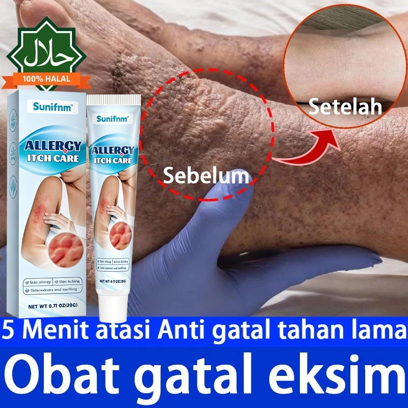 Salep Eksim Kering dan Gatal Salep Gatal Paling Ampuh Cream Gatal Selangkangan Salep Bayi Untuk Kuli