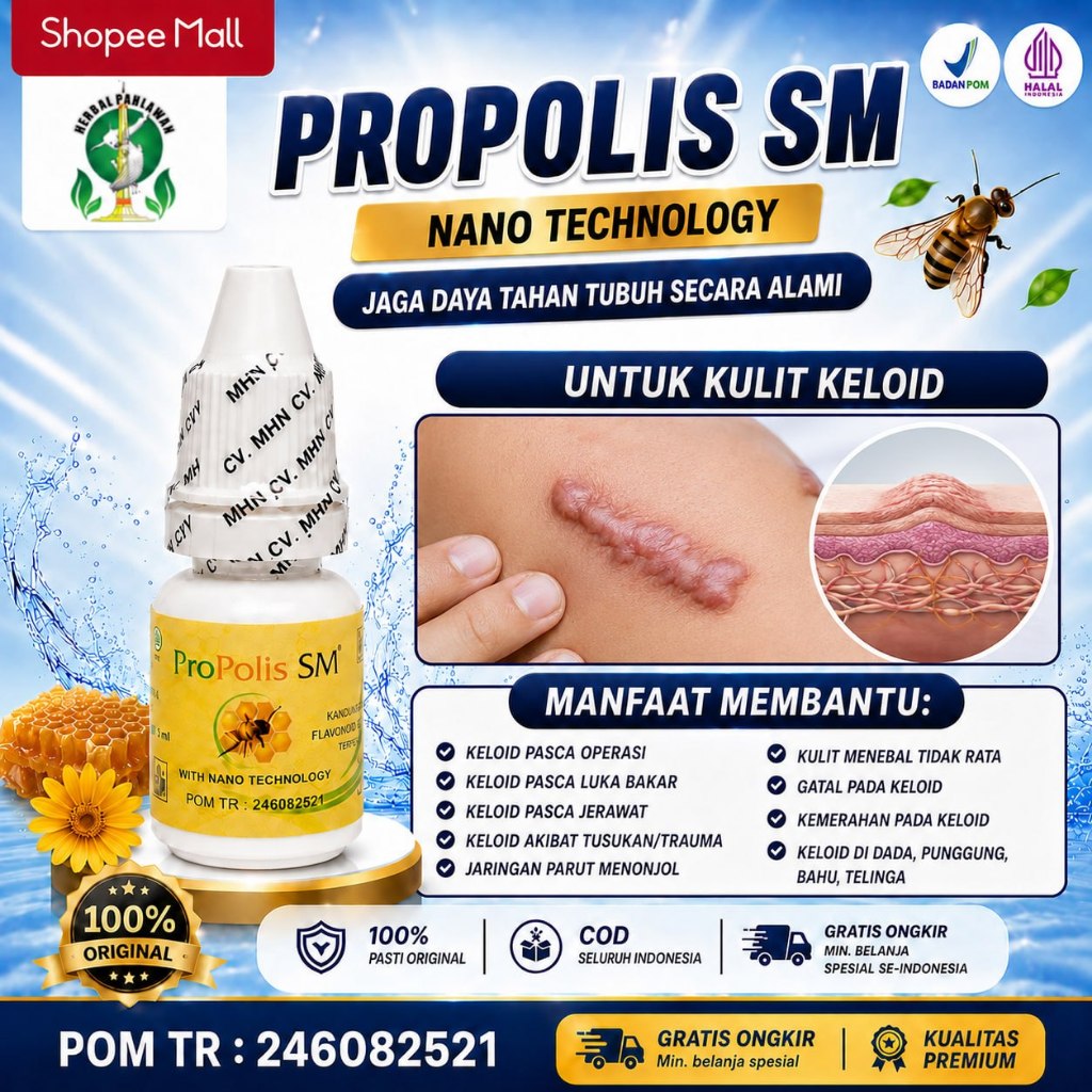 Obat Untuk Kulit Keloid, Keloid Pasca Jerawat, Keloid Pasca Luka Bakar - Propolis SM BPOM