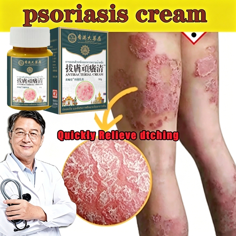 Krim Psoriasis Krim Antijamur Krim Eksim Salep Kulit Serbaguna – Gatal, Jamur & Psoriasis Hilang 3 H