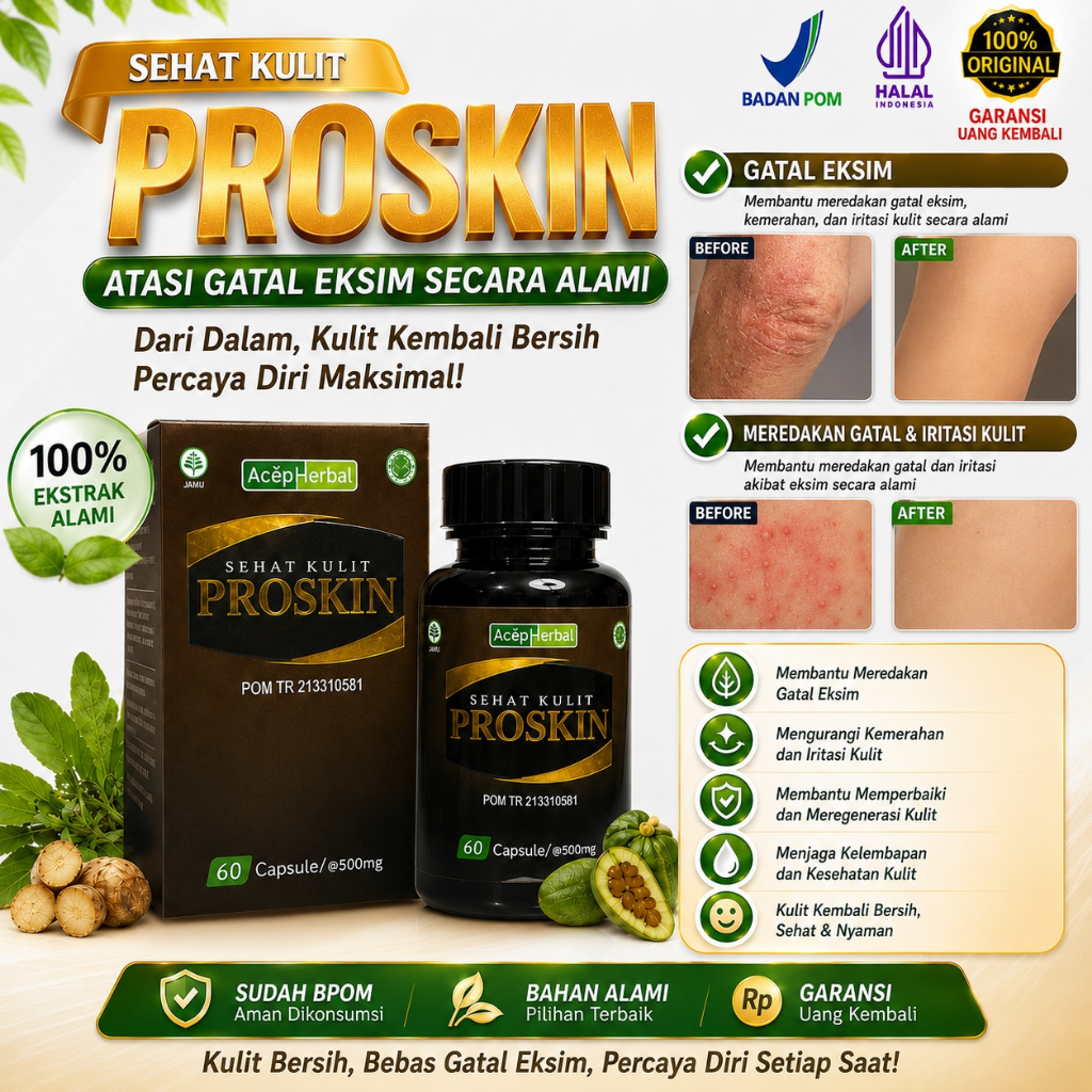 Obat Eksim, Obat Eksim Kering, Obat Eksim Kering Menahun, Obat Eksim Basah, Obat Gatal Eksim, Obat K