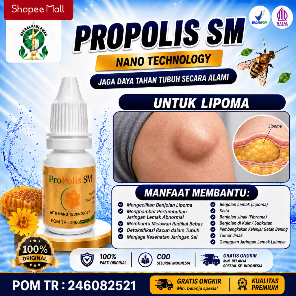 Obat Untuk Lipoma, Kista, Tumor Jinak - Propolis SM BPOM