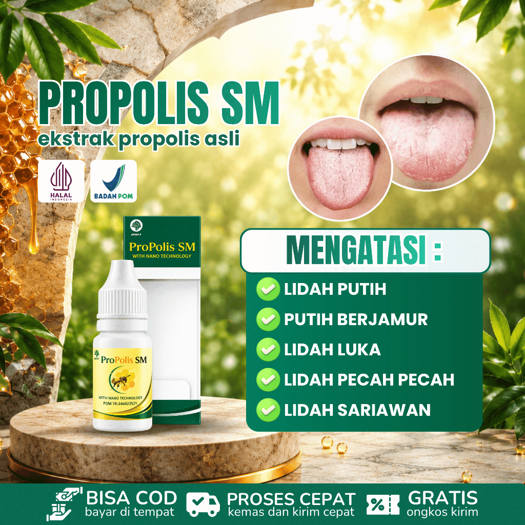 Obat Lidah Putih, Obat Lidah Putih Berjamur, Obat Benjolan Di Lidah, Obat Lidah Luka, Obat Lidah Pec
