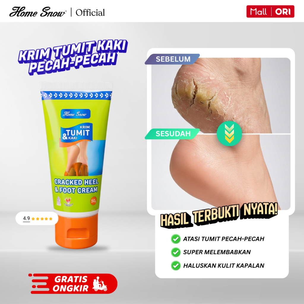 HOME SNOW KRIM TUMIT KAKI CRACKED HEEL & FOOT CREAM 50g Tumit Kaki Pecah dan Kering Hasil Nyata 2 Ha