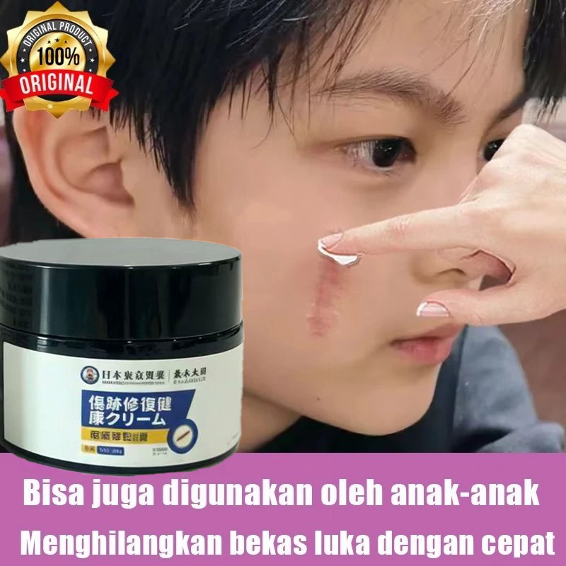 salep penghilang keloid menghilangkan bekas luka Bekas luka operasiPenghilang Bekas cacar penghilang