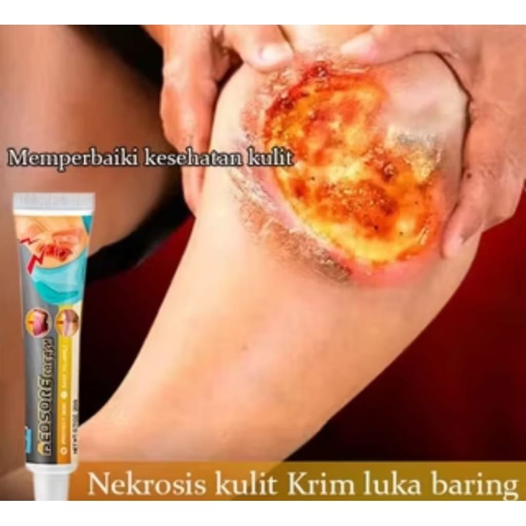 BEDSORE REPAIR CREAM ASLI ORIGINAL salep luka cina ampuh, salep luka bakar, salep luka cepat kering,