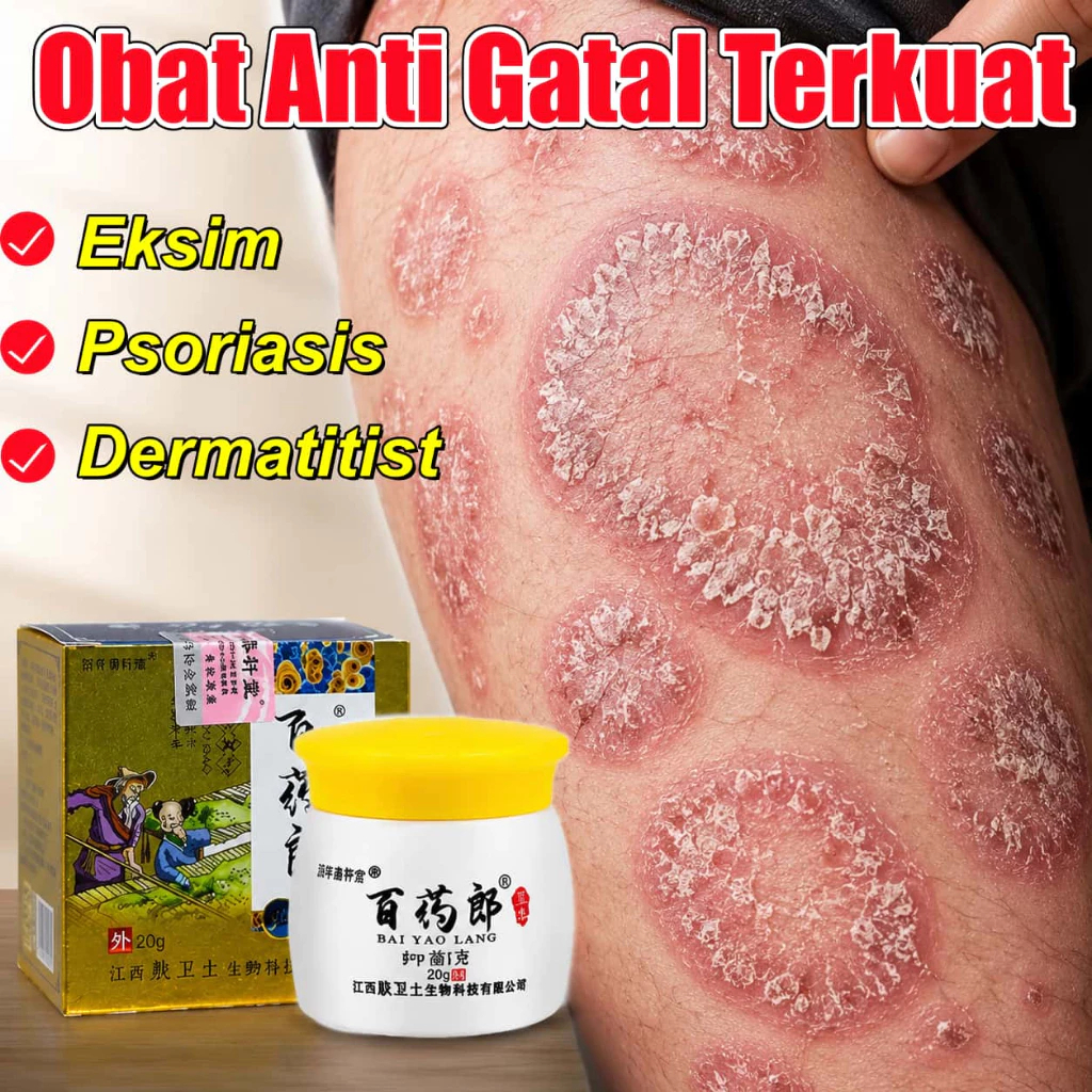 Salep Eksim Kering dan Gatal Salep Gatal China Paling Ampuh Obat Gatal Selangkangan Salep Bayi Untuk