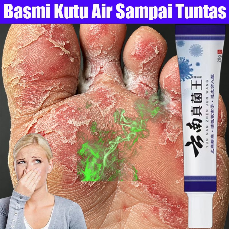 0bat Kaki Rayapan Salep Jamur Kaki Penghilang Bau Kaki 0bat Kaki Jamuran Kaki Bolong Salep Gatal
