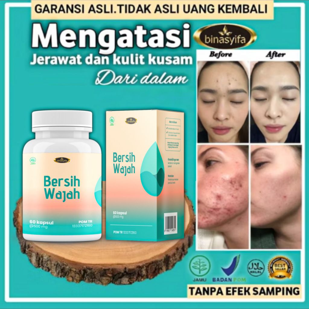 Kapsul Obat Jerawat dan Bekas Jerawat Paling Ampuh BPOM / Herbal Penghilang Jerawat Alami Bersih Dar