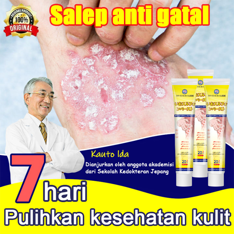 Obat kurap Salep gatal eksim paling ampuh Obat gatal selangkangan 20g salep gatal Salep gatal selang