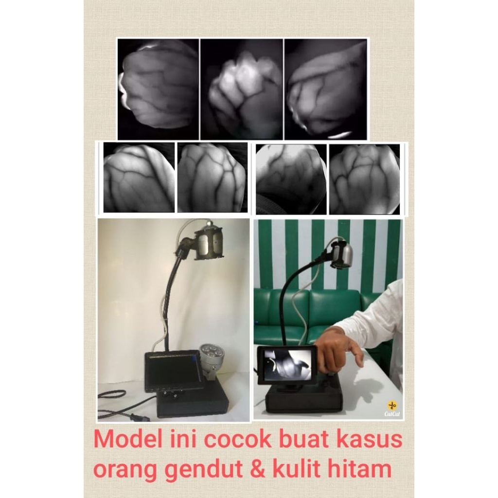 Alat Pencari Vena Saat Pasang Infus Gendut Kulit Gelap Bisa ( Vein Finder Viewer Detector ) IRView