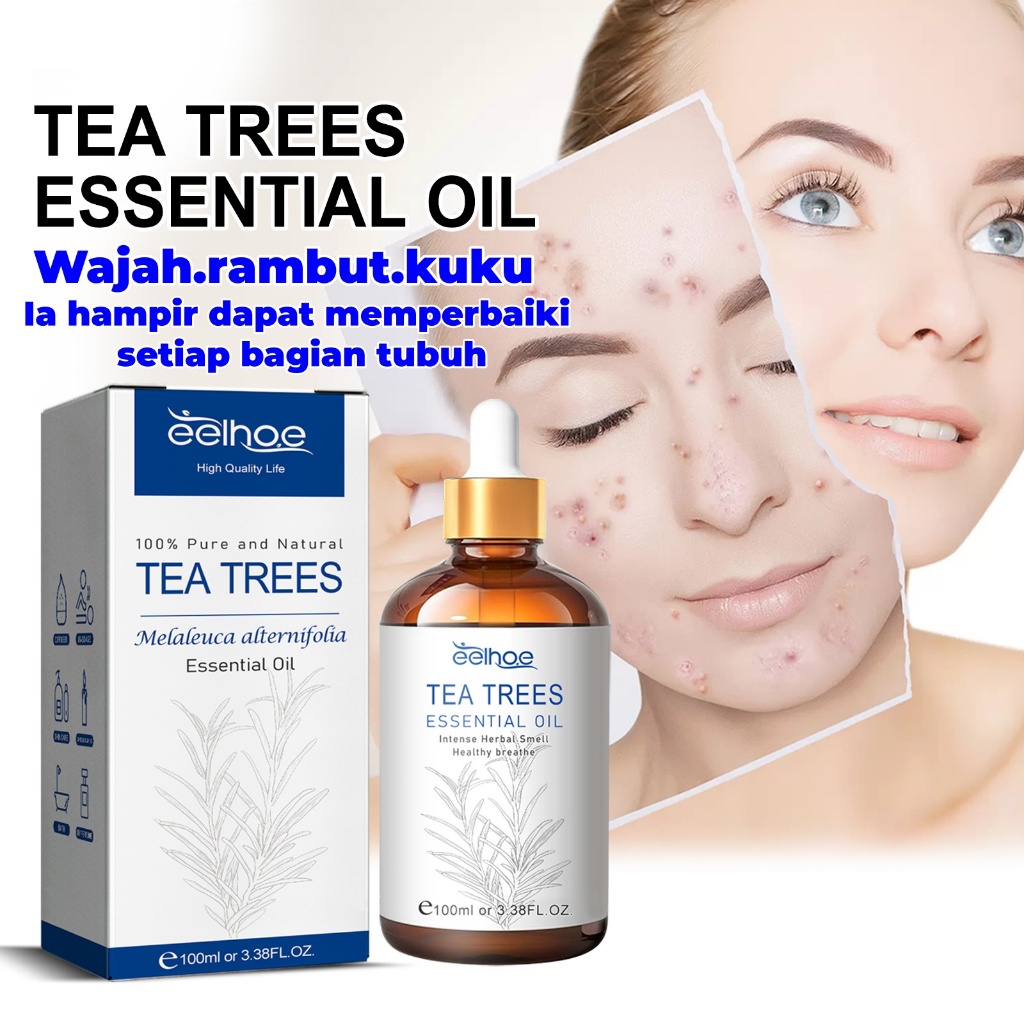 ✅✅✅Tea Trees Essential Oil 100ml Minyak Esensial Pohon Teh Alami Murni Intense Herbal Smell Mencerah
