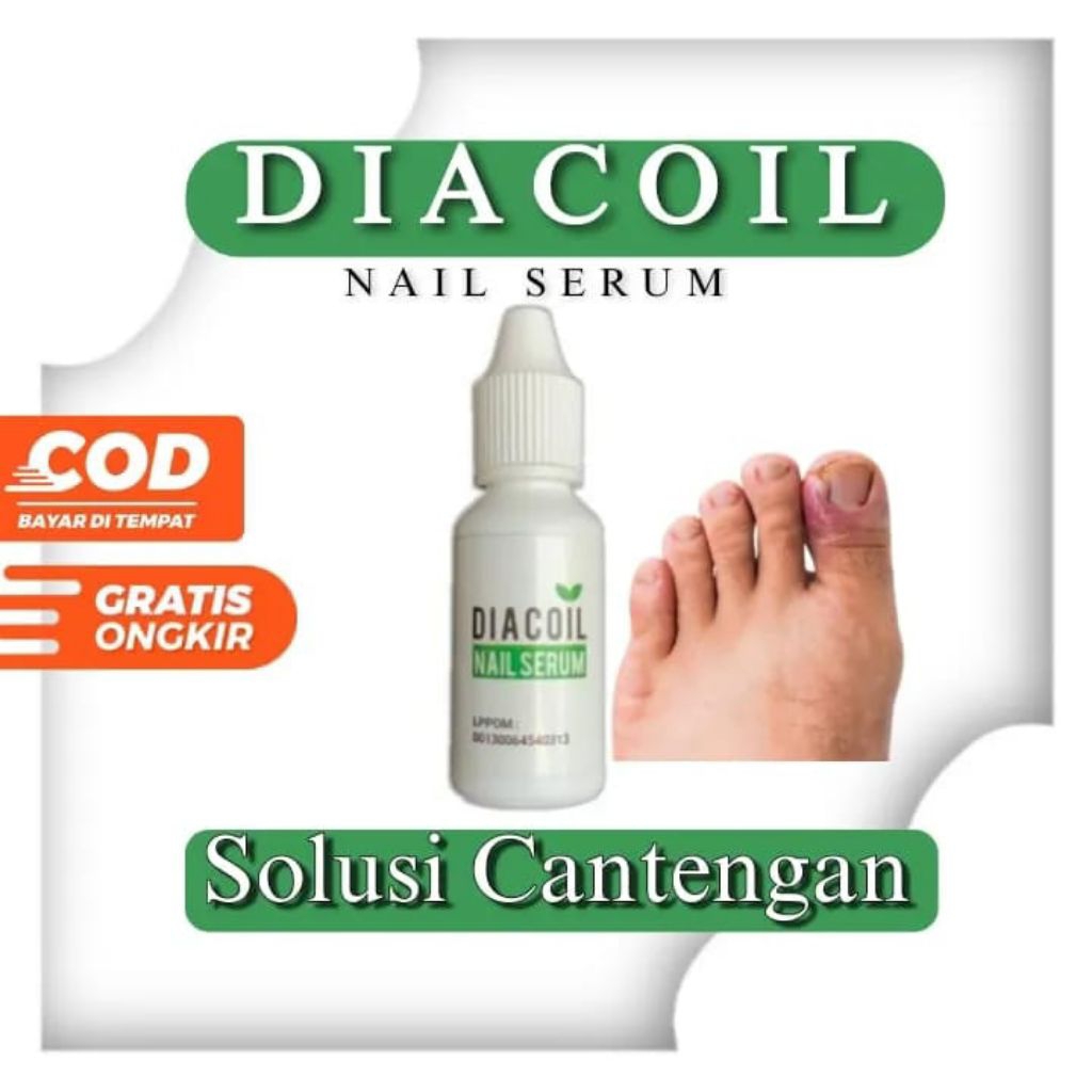 DIACOIL NAIL SERUM ORIGINAL | OBAT JAMUR KUKU |
CANTENGAN DAN BERNANAH | AMPUH 100%