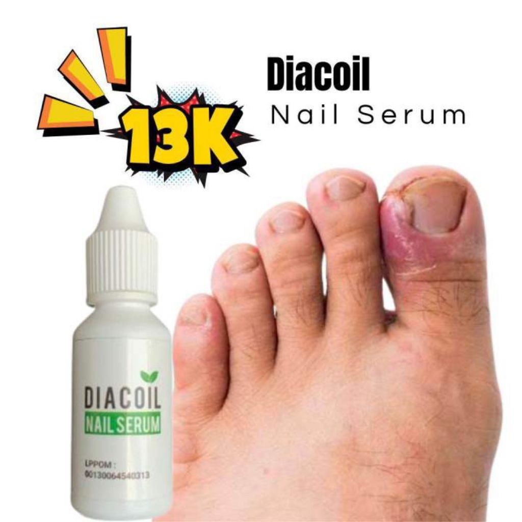 DIACOIL NAIL SERUM ORIGINAL | OBAT JAMUR KUKU |
CANTENGAN DAN BERNANAH | AMPUH 100%