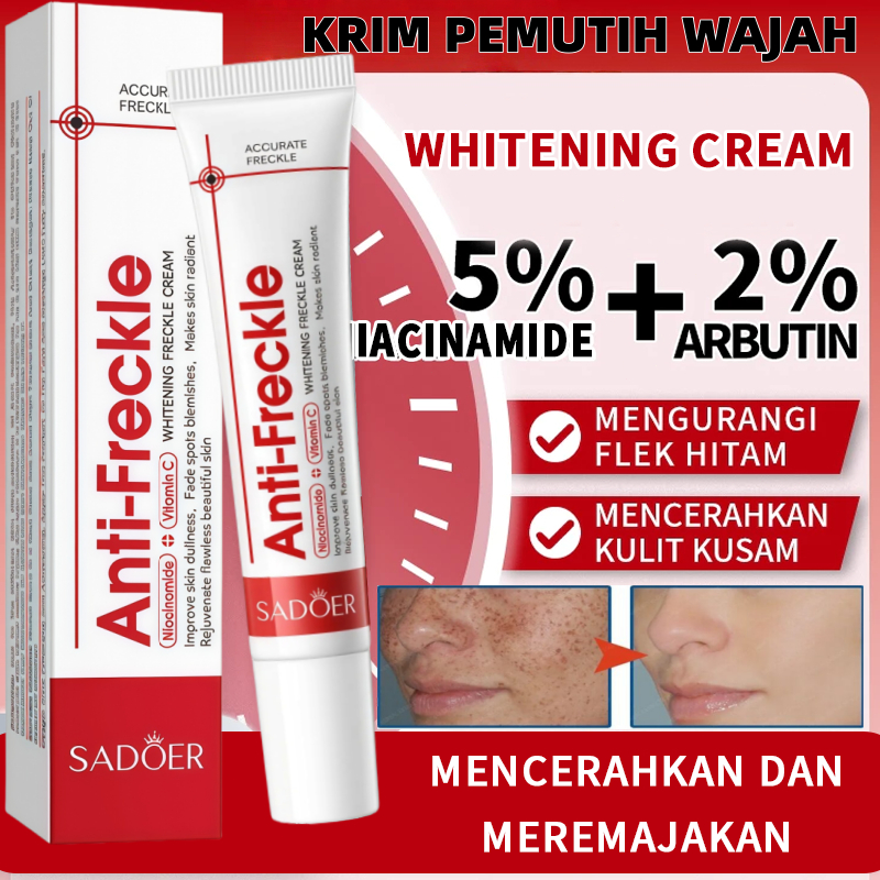 Whitening blemish  Freckle Cream Remove Dark Spots Anti Freckle Cream Niacinamide Fade Pigmentation 
