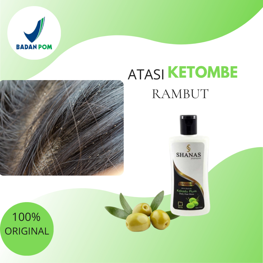 SAMPO SANAS SHAMPO SHANAS OBAT KUTU RAMBUT AMPUH DAN TELUR KUTU SHANAS NASA PENGHILANG KUTU SAMPO SH