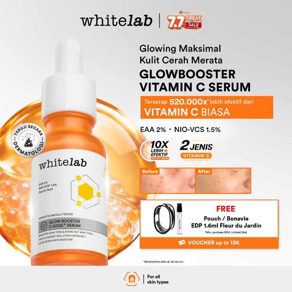 Whitelab Serum Vitamin C Glow Booster - Antioksidan Tinggi untuk Kulit Cerah dan Glowing C-Dose+ den