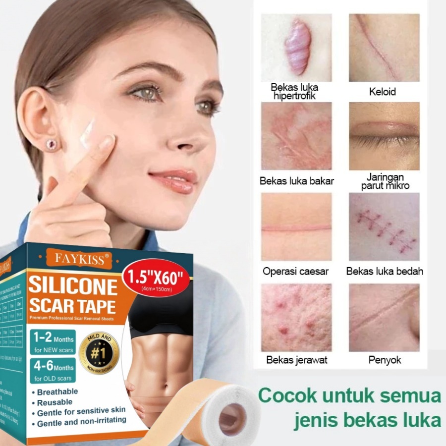 Silicone Scar Sheet plester silikon penghilang keloid bekas luka Scar patch Silicon Keloid Plester B