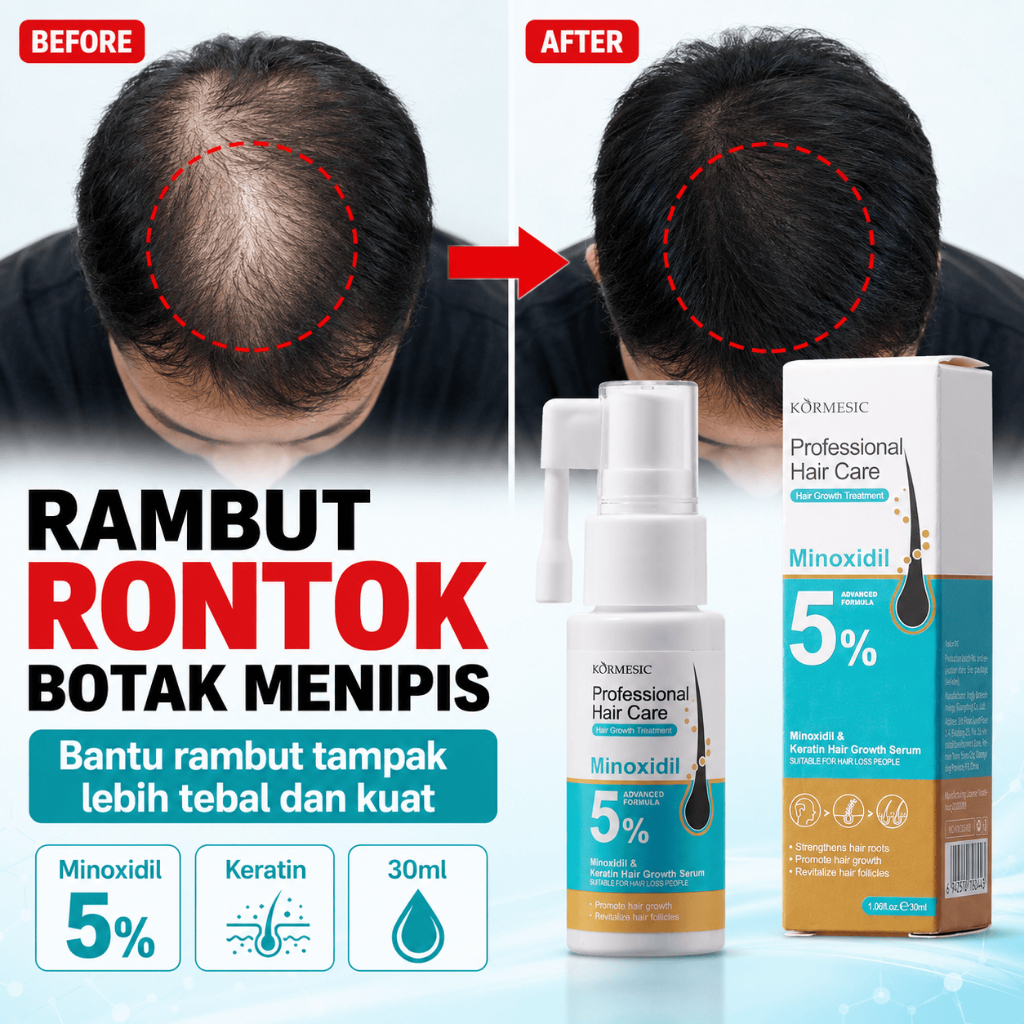 Serum Penumbuh Rambut Minoxidil 5 Persen Kormesic 30ml Hair Growth Serum Untuk Rambut Rontok Botak M