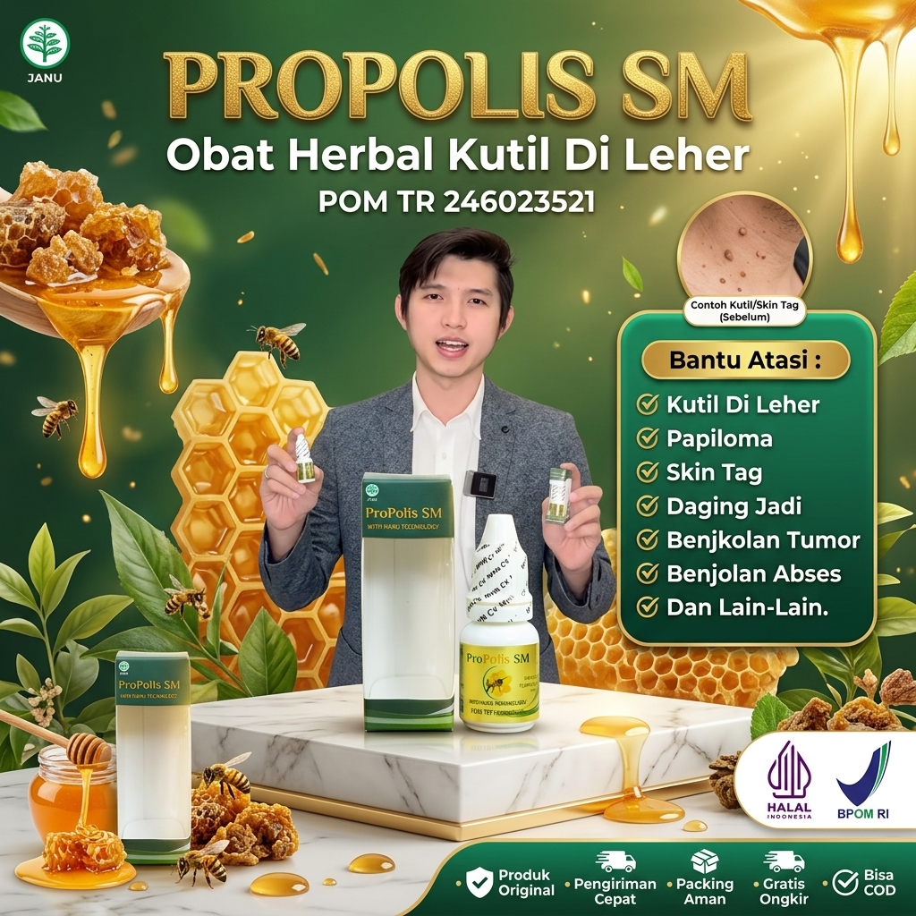 PROPOLIS SM - Obat Tetes Oles Penumpas Skin Tag di Leher, Skin Tag, Obat Penghilang Skin Tag, Papill