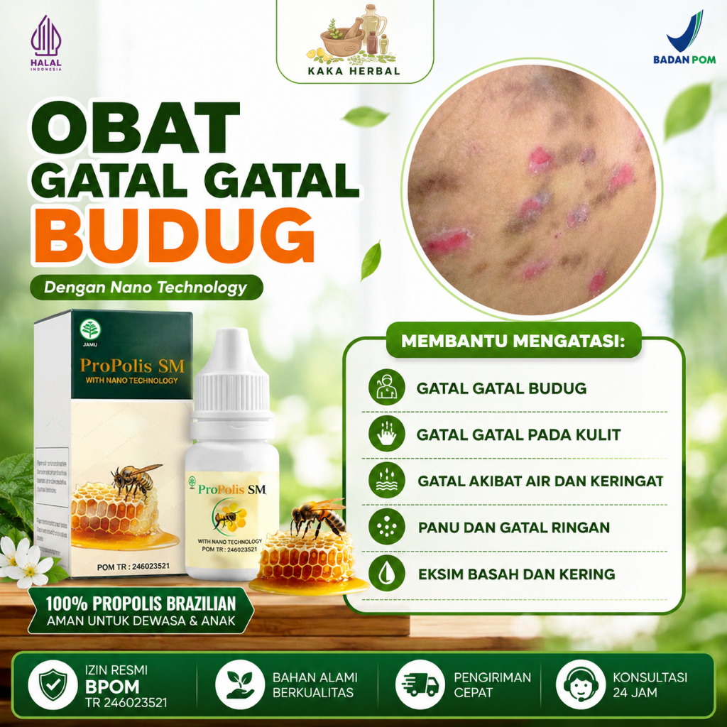 Obat Kutu Air,  Kuman Air, Kutu Air Pada Kaki, Kutu Air Pada Sela Jari kaki, Gatal Parah di Tangan, 