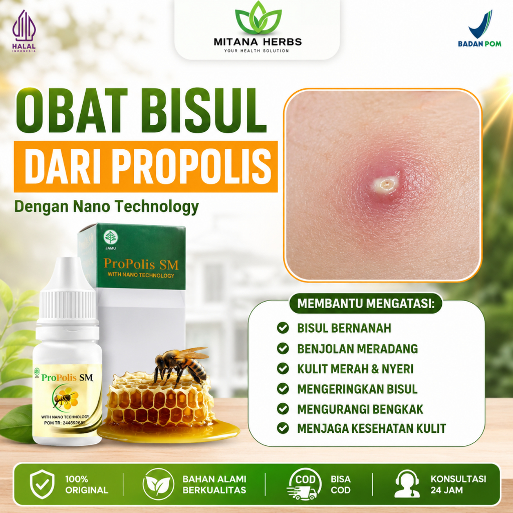 Obat Bisul, Bisul Bernanah, Bisul di Pantat, Bisul di Tangan, Bisul Biar Gak Tumbuh Lagi, Bisul Di K