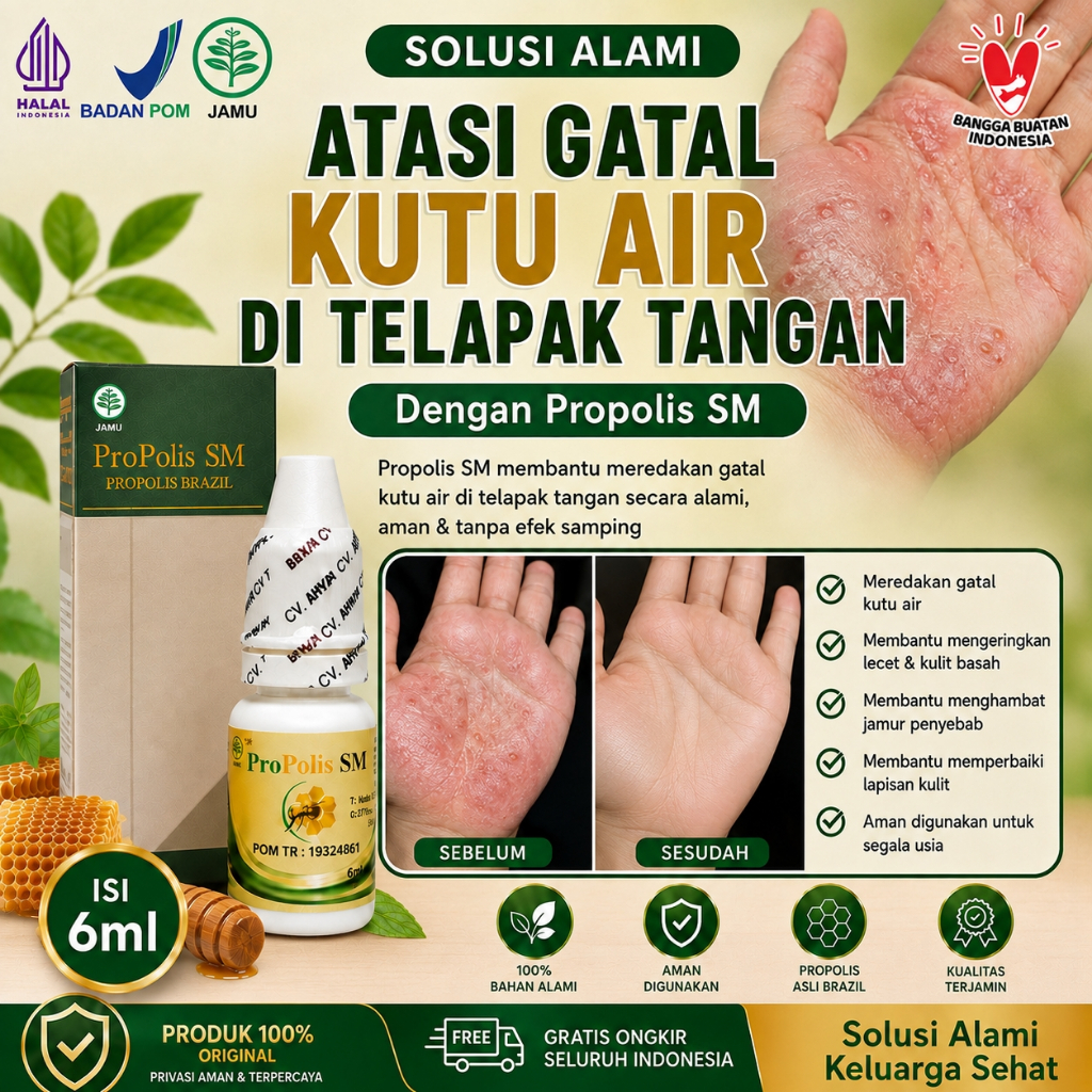 Obat Kutu Air Di Tangan, Obat Kutu Air Di Jari, Obat Kutu Air Di Kaki, Obat Kutu Air Telapak Kaki, O