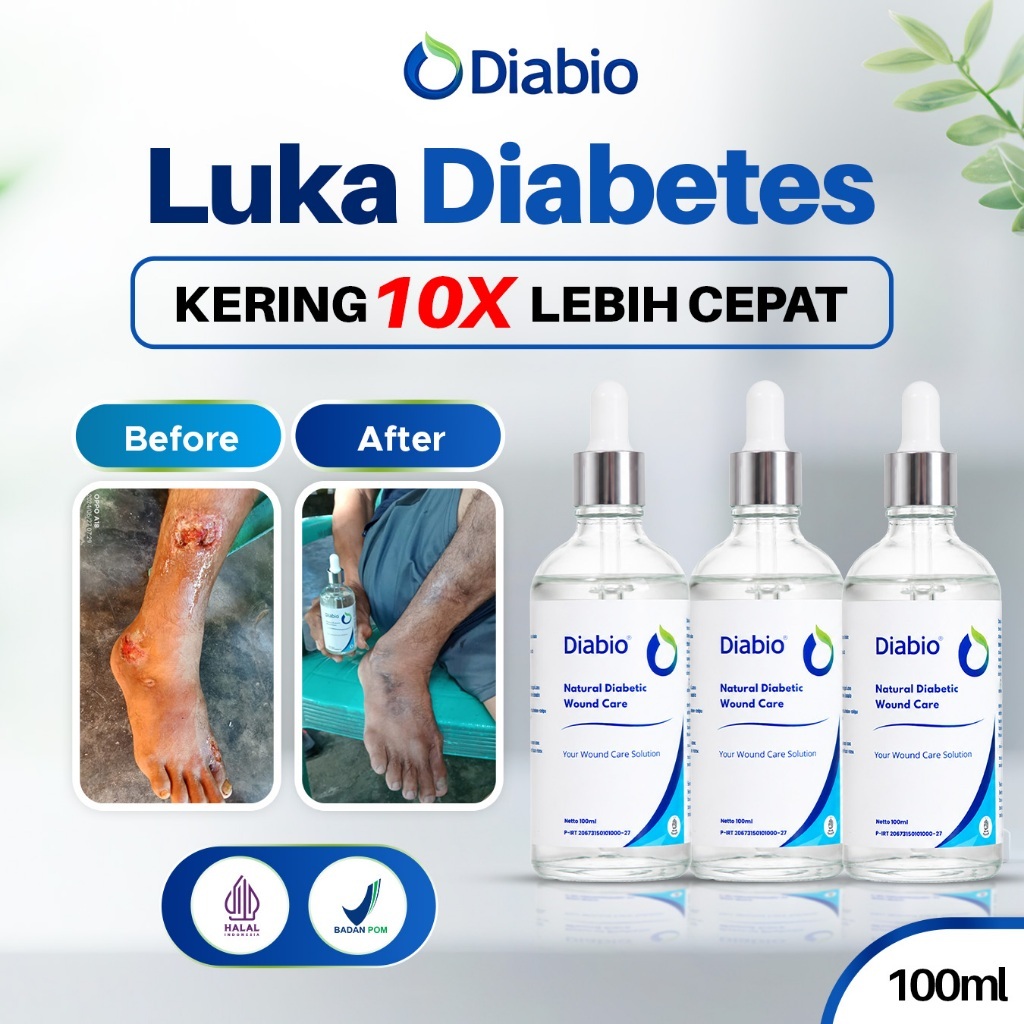 DIABIO Obat Luka Diabetes Alami | Luka Borok | Luka Bernanah luka diabetes l Wound Care