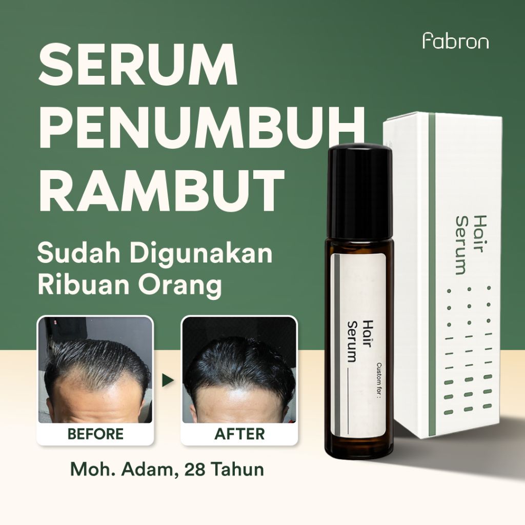 Custom Hair Serum by Fabron | Minoxidil 5% + Finasteride 0,1% | Treatment Rambut Pria