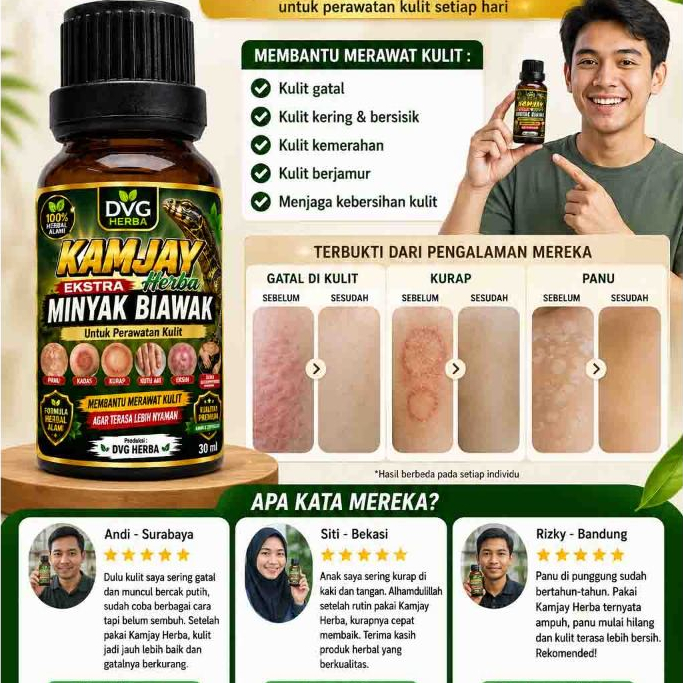 Ekstra Minyak Biawak Kamjay Herba Atasi Panu Kadas Kurap eksim kutu air gatal selangkangan