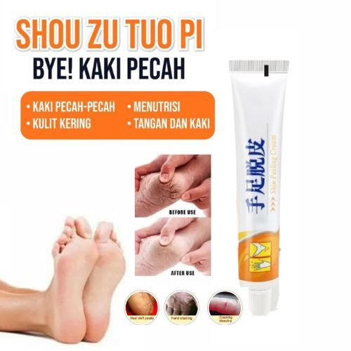 Salep Skin Peeling Cream Salep Tangan Kaki Pecah Kering Kasar Atau Kapalan Menghaluskan kulit