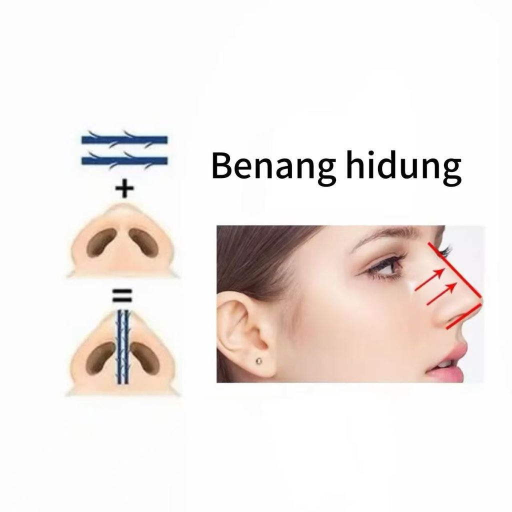 (20pcs) MINERVA Benang Hidung Thread Lift PDO 19G*38MM 60MM