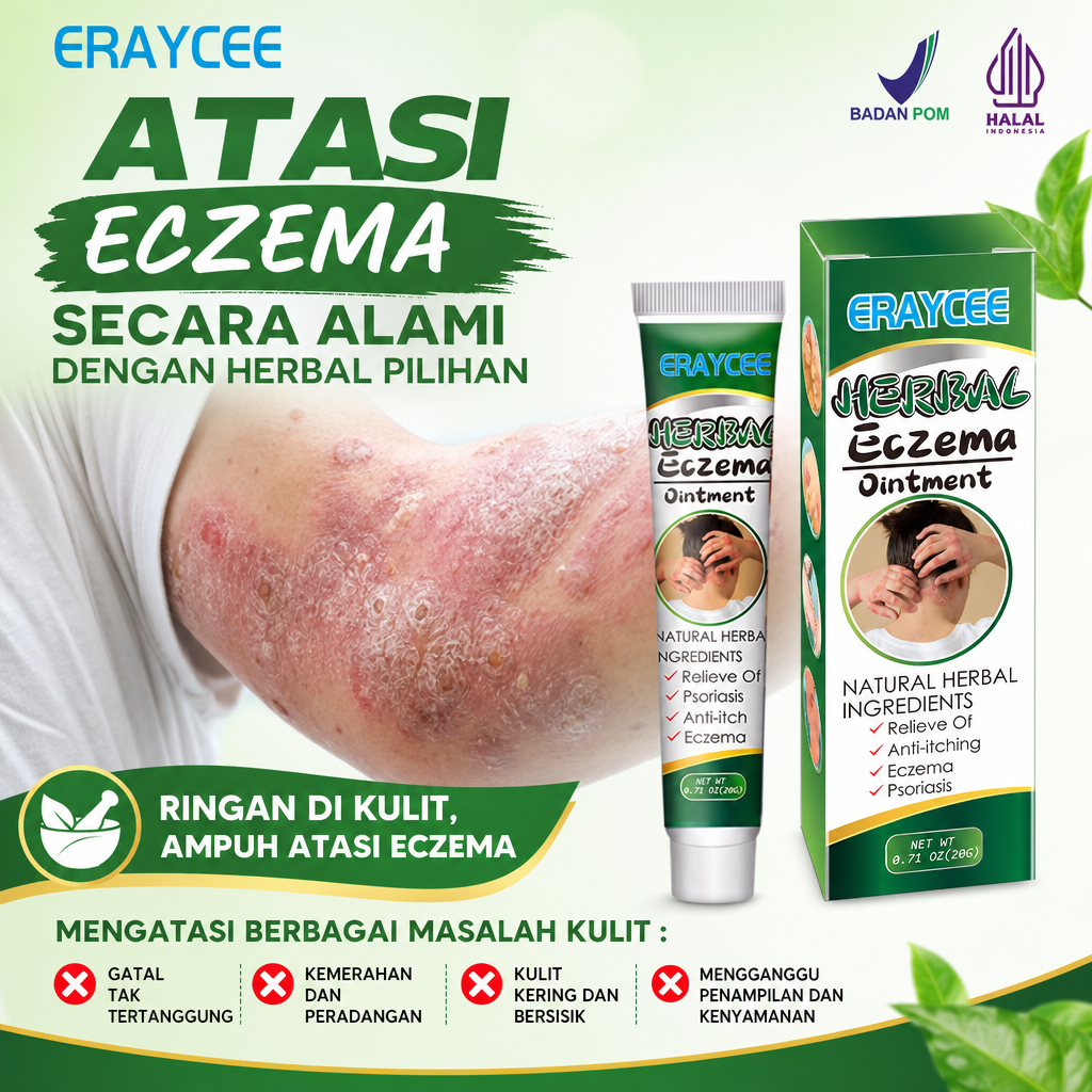 Salep penghilang gatal cepat, cocok untuk gatal-gatal pada kulit, kurap pada tangan dan kaki, kurap 