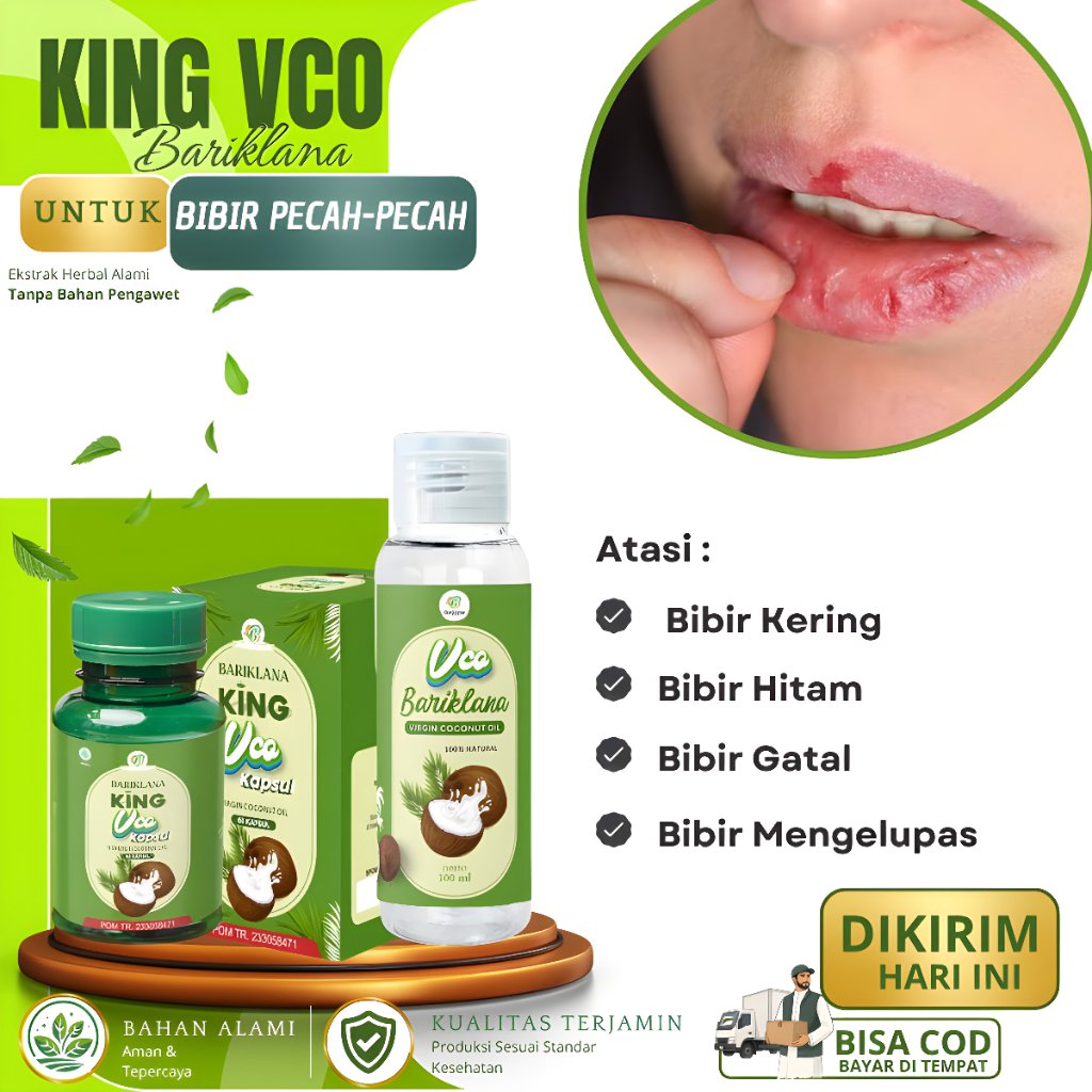 VCO - Obat  Bibir Pecah-pecah, Bibir Kering, Bibir Hitam, Bibir Gatal, Bibir Mengelupas, Bibir Terba
