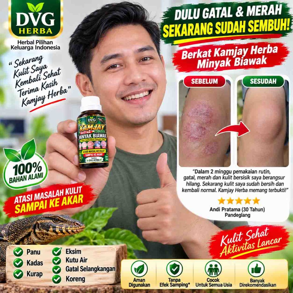 DVG Herba Kamjay Herba Minyak Biawak obat kulit untuk panu kadas eksim kutu air