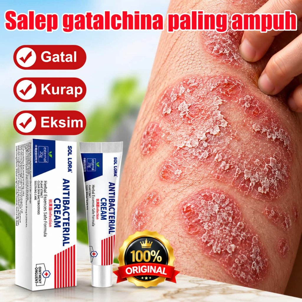 Salep China Gatal Paling Ampuh Salep Eksim Kering Dan Gatal Psoriasis Cream Obat Kurap Salep Gatal A