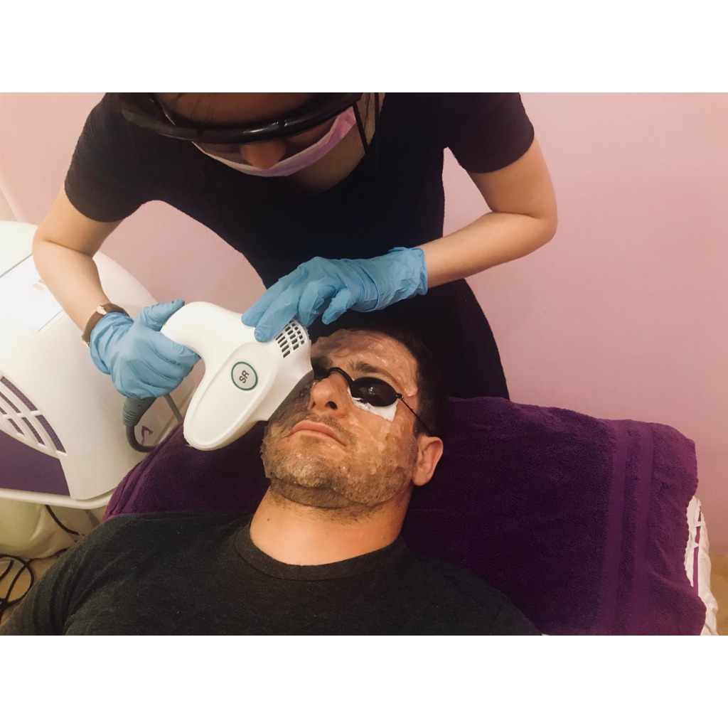 Combo Wajah Lebih Cerah & Berkilau (Laser Rejuv & Chemical Peeling) - 1x