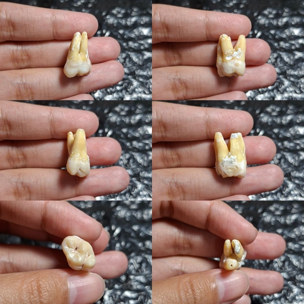 Gigi Molar 27