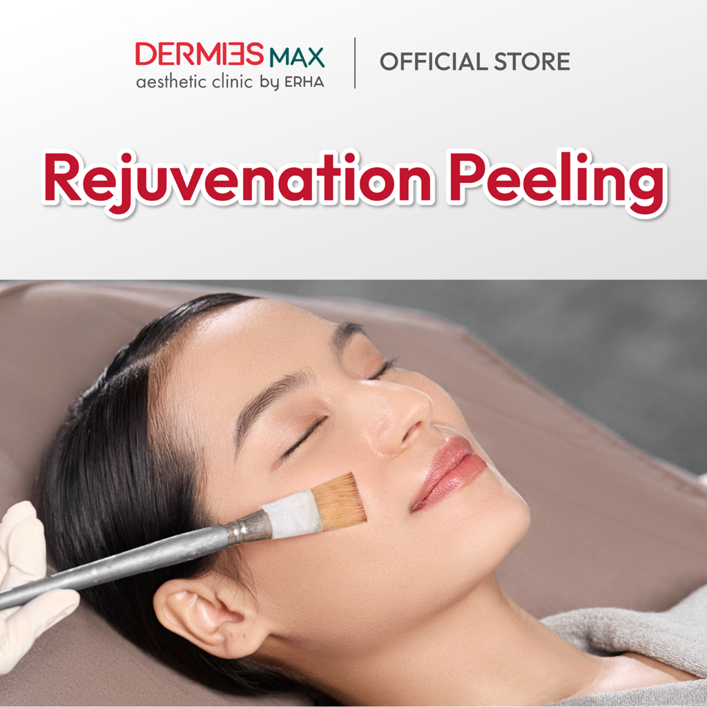 Dermies Max Rejuvenation Peeling