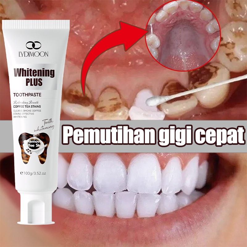 Pasta gigi pemutih odol pemutih gigi dan karang gigi odol pemutih gigi odol gigi odol gigi pemutih p