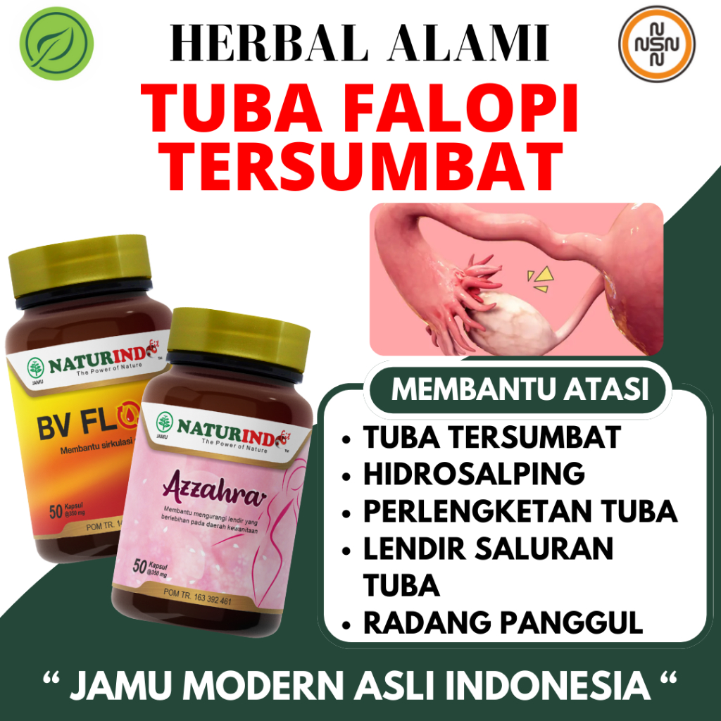 Herbal Tuba Falopi Tersumbat Hidrosalping Tuba Tersumbat Nonpaten Bilateral Naturindo