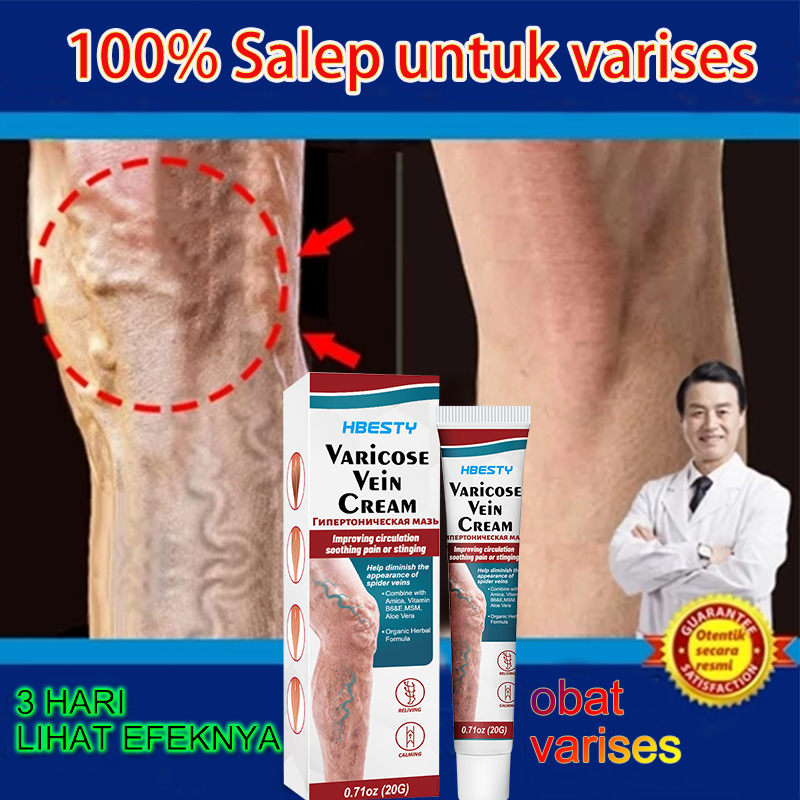 100% Asli Obat Varises Asli 20g Salep Penghilang Varises Ampuh Obat Varises Original Obat Varises Di