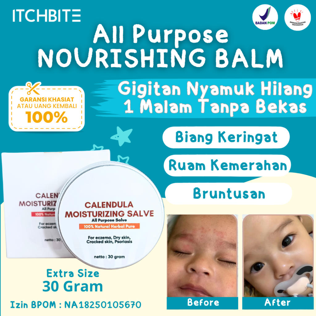 Salep Ruam Merah Popok Beruntusan Biang Keringat Anak Bayi All Purpose Nourishing Moisturizer Balm