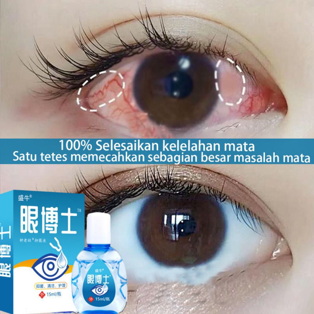 EYE DROP TETES MATA JEPANG TETES MATA KATARAK MATA MERAH MATA IRITASI KETEGANGAN MATA