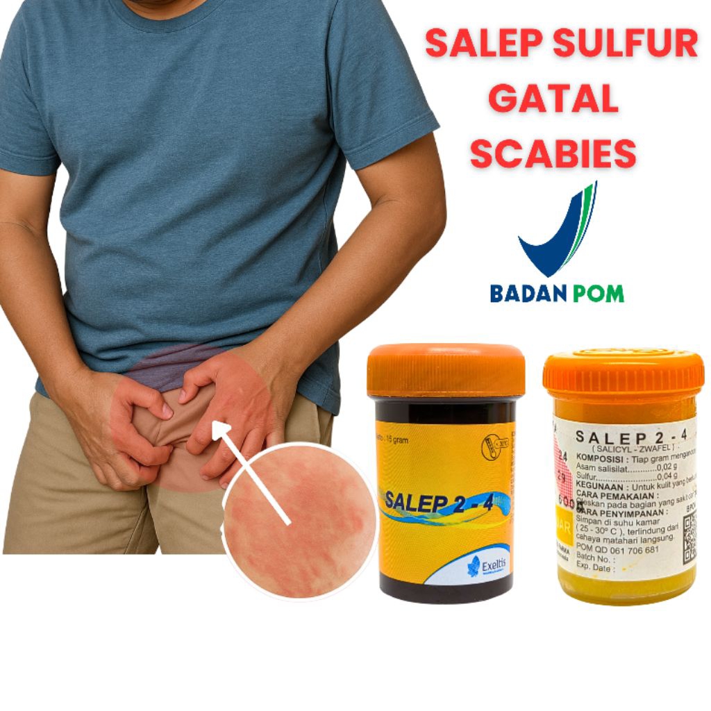 Salep Gatal Paling Ampuh Untuk Penyakit Kulit Di Selangkangan Salep 2-4 Sulfur Untuk Scabies Kudis